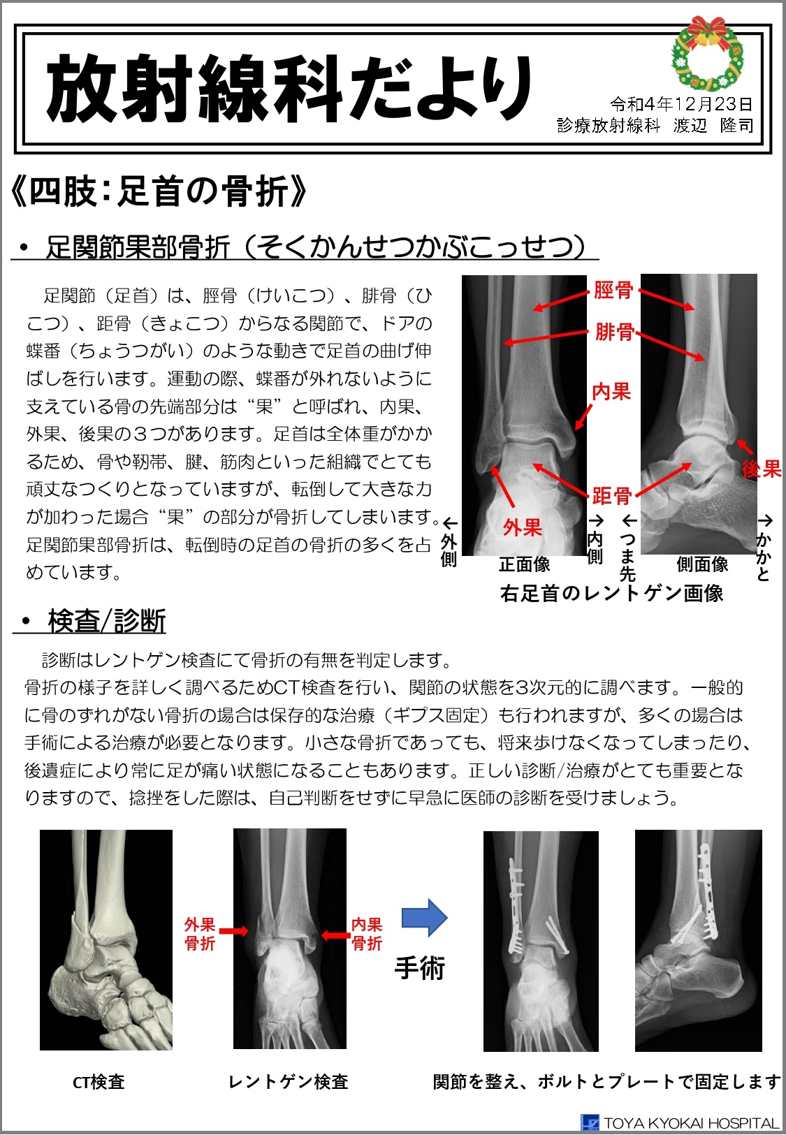 xp_info_20221222.jpg