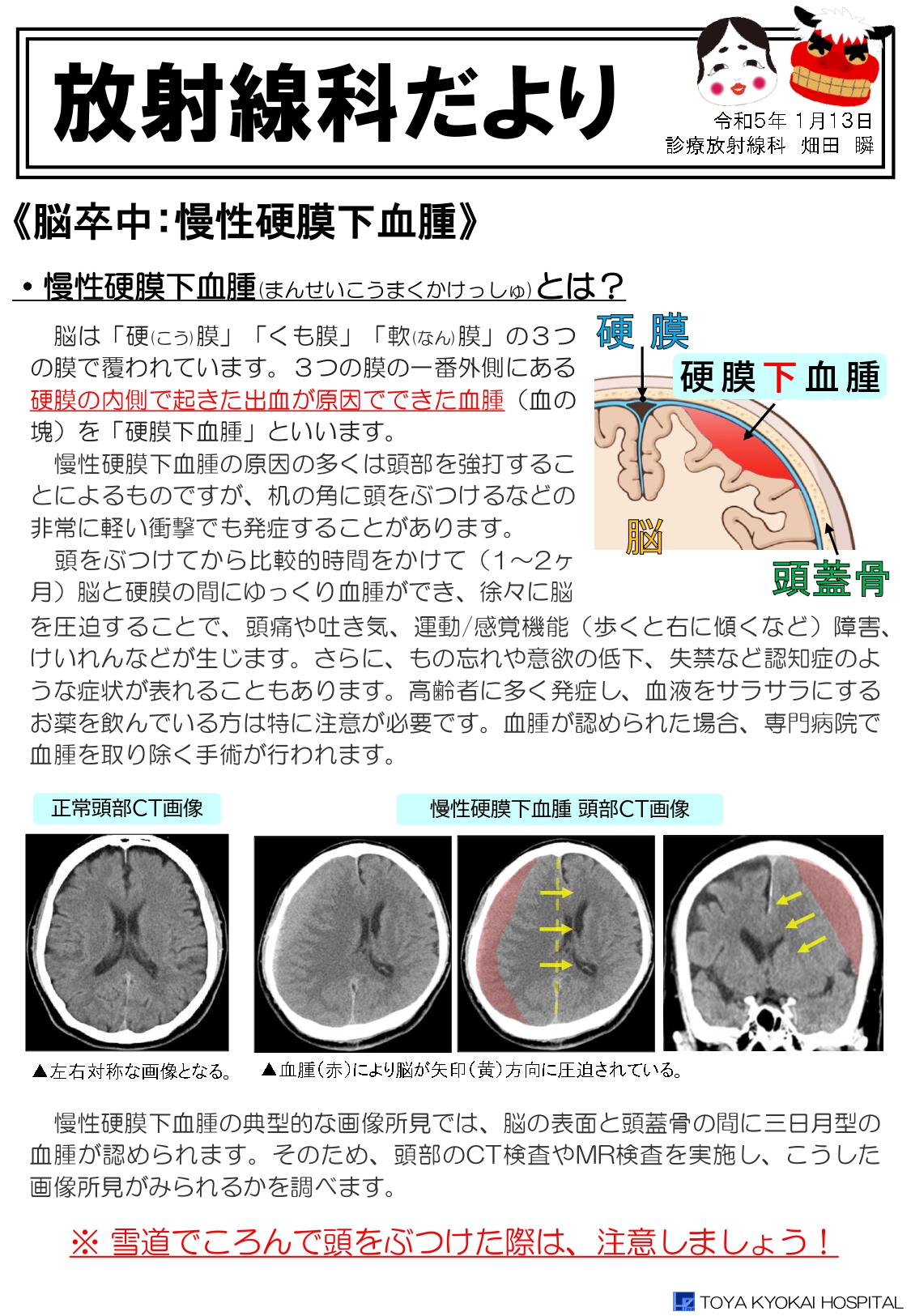 xp_info_20230113.jpg